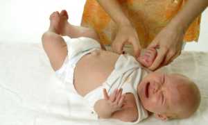 Виды пластырей при пупочной грыже у новорожденных детей, особенности применения