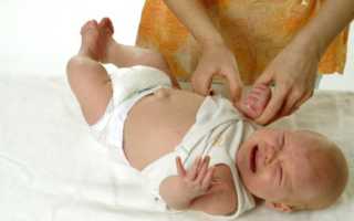 Виды пластырей при пупочной грыже у новорожденных детей, особенности применения