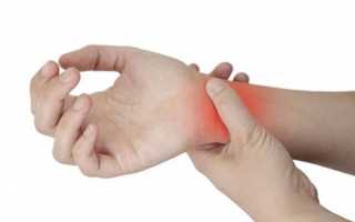 Боль в лучезапястном суставе: возможные причины лечение