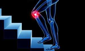 Почему болит колено во время ходьбы и что с этим делать?