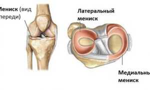 Киста в коленном суставе: лечение, симптомы, диагностика, виды кисты