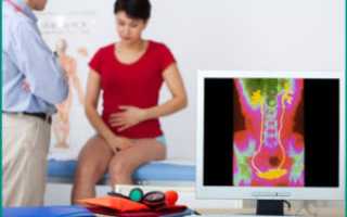 Этиология и лечение почечных болей при цистите