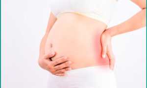Камни в почках у беременных: последствия и лечение