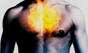 Жжение в грудине посередине — причины возникновения у мужчин и женщин, сопутствующие проявления