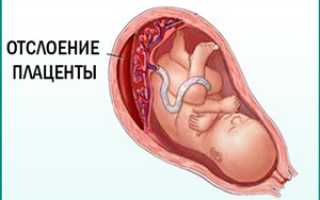 Кишечная палочка в моче беременных женщин