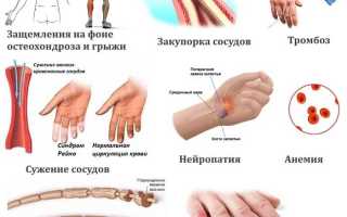 Немеет левая рука (парестезия) — ищем причины онемения