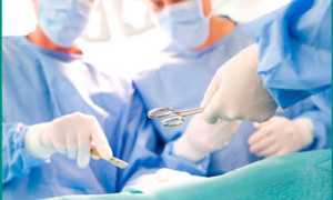 Лапароскопическая операция для лечения мужской патологии