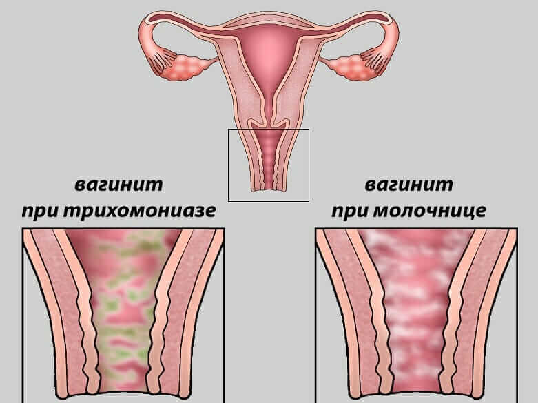 Диагностика Диагностика