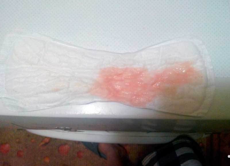 Но не всегда все просто Но не всегда все просто